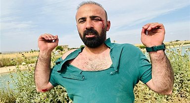 HDP Şanlıurfa İl Eş Başkanı Atış, saldırıya uğradı