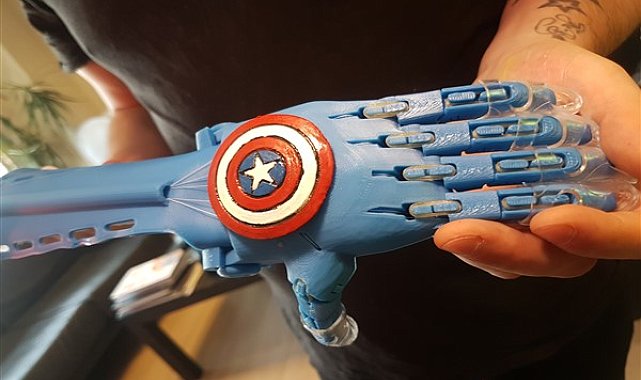 Alternatif Bank ve Robotel Derneği, uzuv kaybı yaşayan çocuklar için el ele verdi