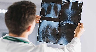 “Dr. Türktemiz; İyonlaştırıcı Radyasyonun Olumsuz Etkilerini Azaltmak Mümkün