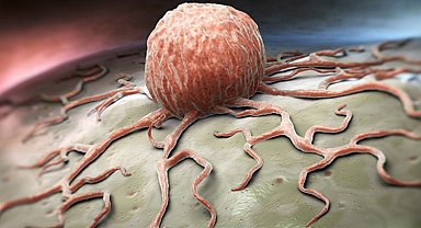 Kanser görülme sıklığı 50 yaşın altına indi