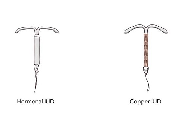 Grönlandlı kadınlar Danimarka devletine doğum kontrolü 'ihlali' nedeniyle dava açtı