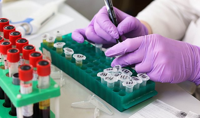 Oncosem'in test kitinin ürün takip sistemine kaydı