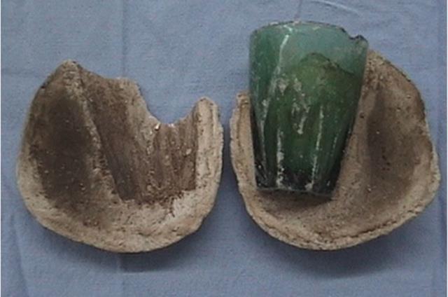 kadının cinsel organından bardak çıktı